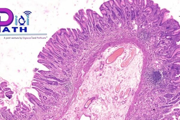 DigiPath: Pioneering the Digital Revolution in Diagnostic Pathology