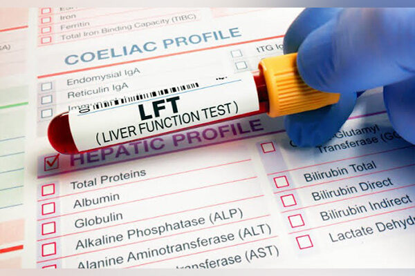 When Should You Get Liver Function Tests Done? Signs and Symptoms that Warrant Testing