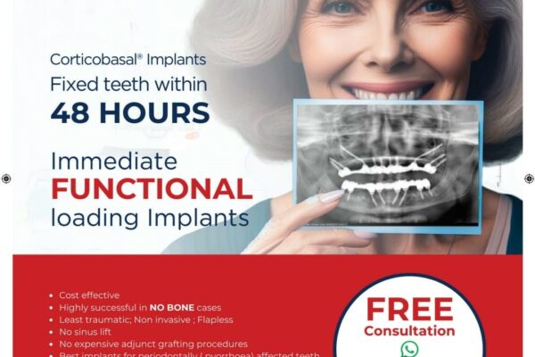 Immediate Loading Dental Implants: Simpladent Clinics Revolutionize Oral Health with 48-Hour Full Mouth Rehabilitation