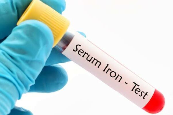 5 Signs You Need to Get an Iron Test Done