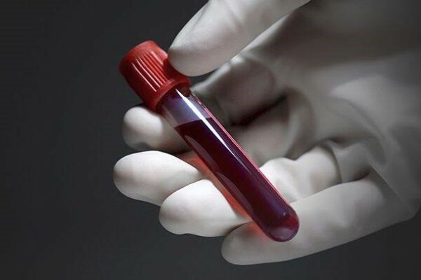 Which Blood Test Can Help Detect Infections?