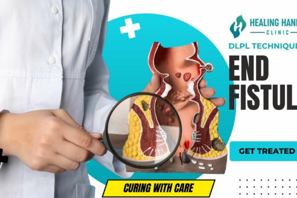 How to Cure Fistula Permanently?- DLPL Fistula Treatment