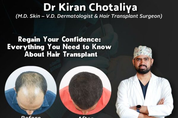 Best Hair Transplant in Pune: Dr. Kiran Chotaliya’s Expertise in latest Hair Transplant Technique