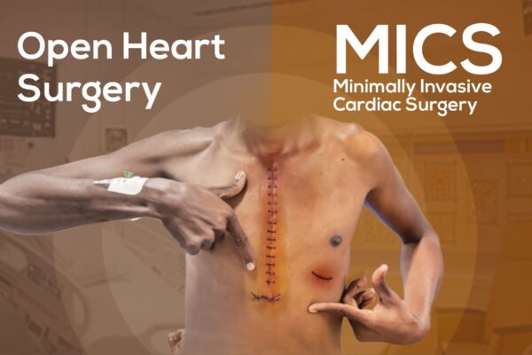 Transforming Heart Care: A Traveler’s Guide to Minimally Invasive Cardiac Surgery