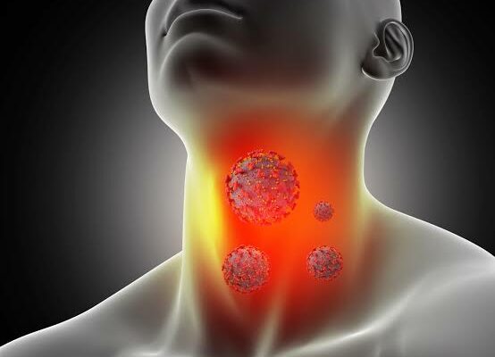 How to Treat Sore Throat?