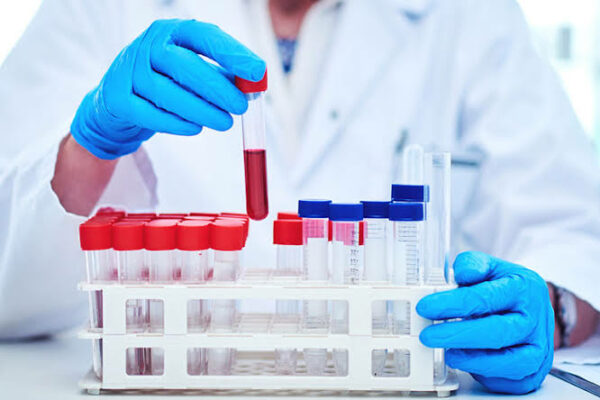 Getting sick frequently? Book a CBC test to know the cause