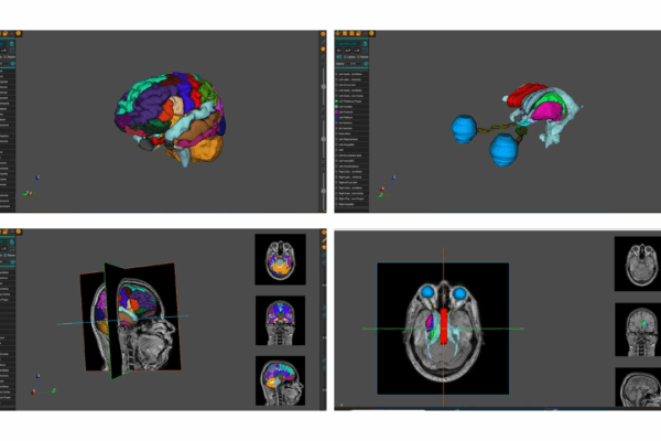 AnaVu: IIIT-Hyderabad’s 3D Anatomy Visualization Platform Transforming Medical Education